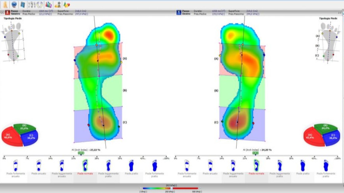 Posturologia ed odontoiatria un “matrimonio” possibile?