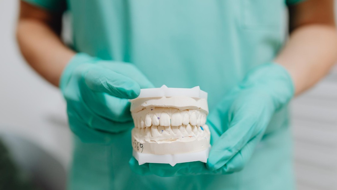 Dentiera fissa su impianti