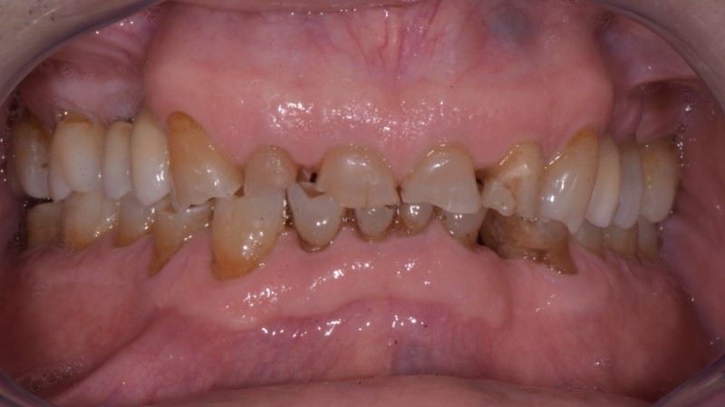 Prima del trattamento