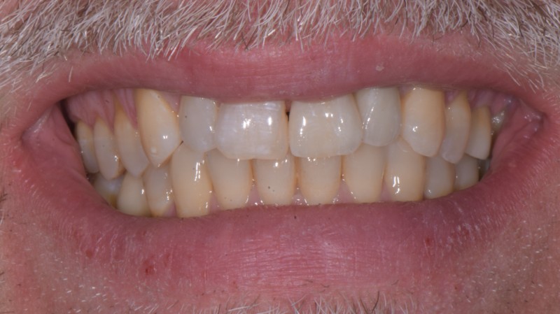 Impianto in zona estetica