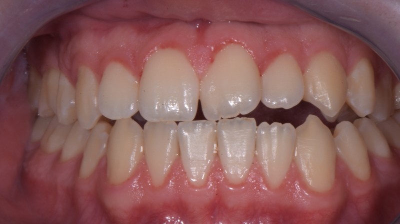 Prima del trattamento