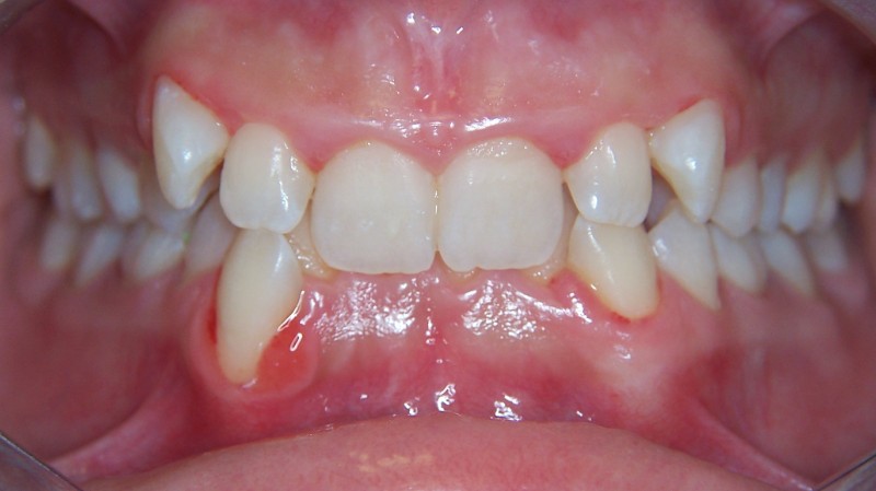 Prima del trattamento