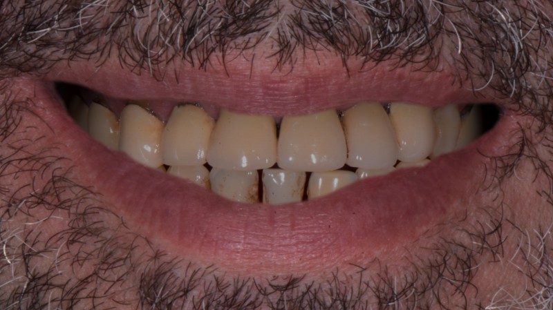 Prima del trattamento