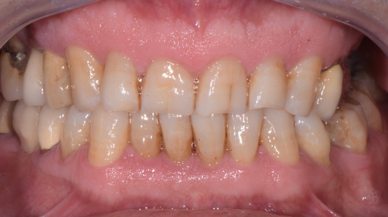 Prima del trattamento