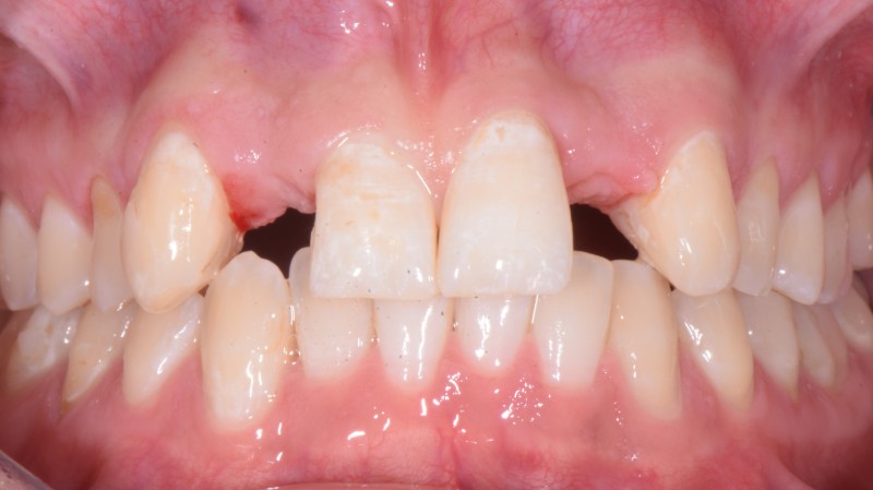 Prima del trattamento